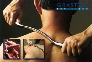 Graston Technique uses special smooth metal bats to "comb" out Trigger Points