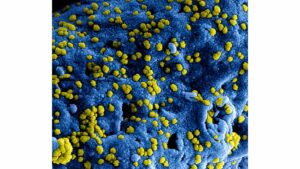 Virus on a Membrane