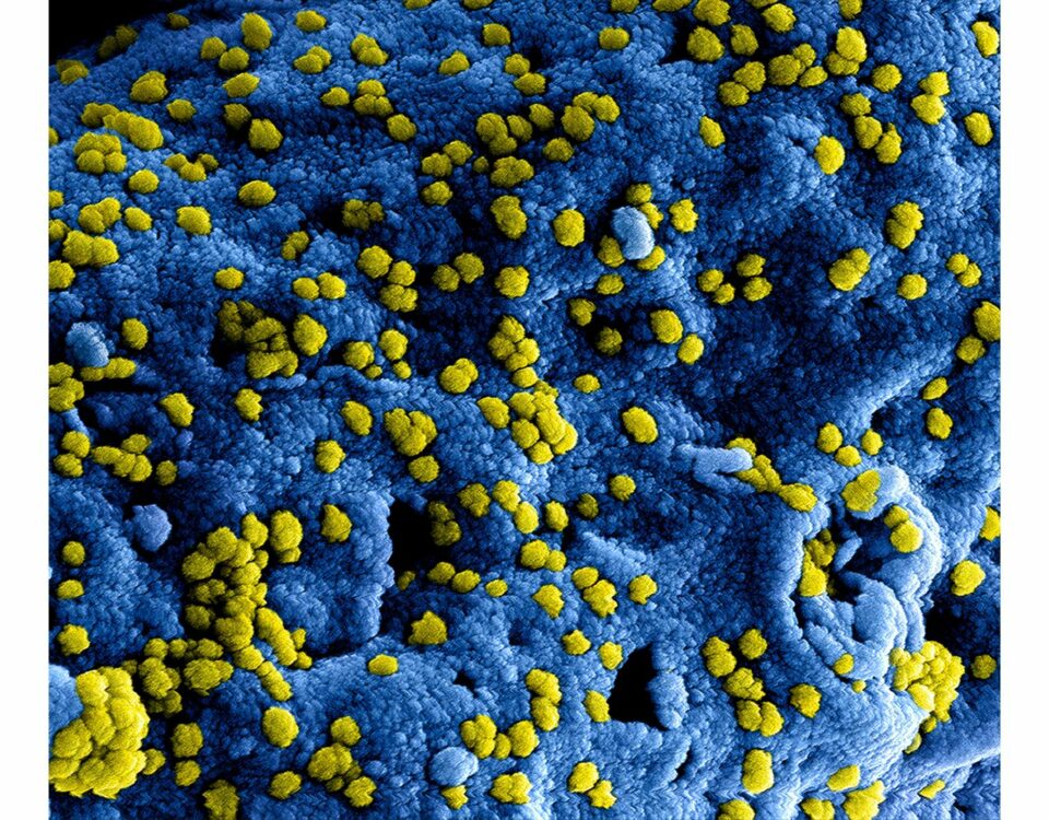 Virus on a Membrane