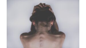 The neck and back of a woman below healthy weight whith some muscle wasting