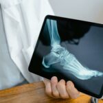 An Xray of a foot to show bobne health