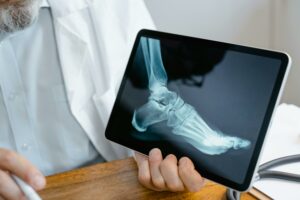 An Xray of a foot to show bobne health