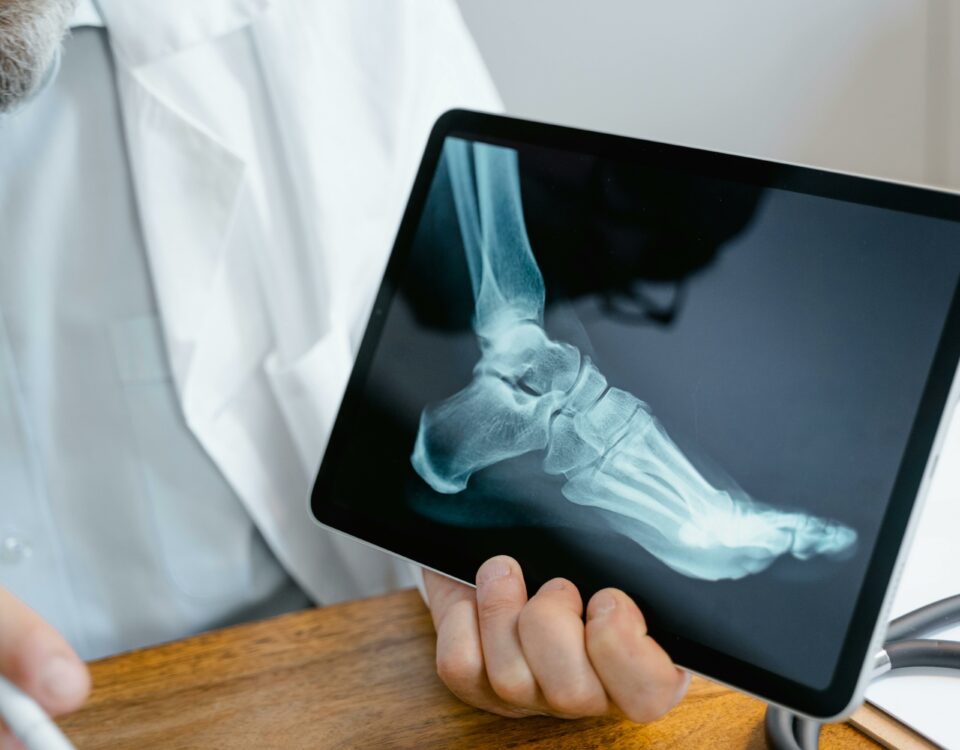 An Xray of a foot to show bobne health